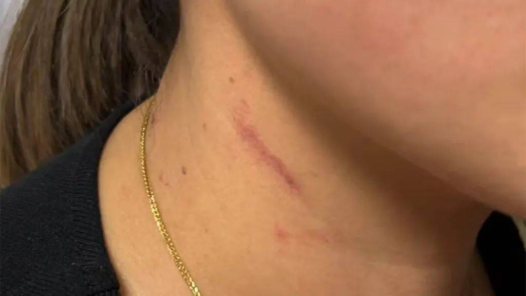 皇冠信用网会员_云南一男子酒后逼问妻子“是否出轨”并施暴皇冠信用网会员，被警方行拘4日