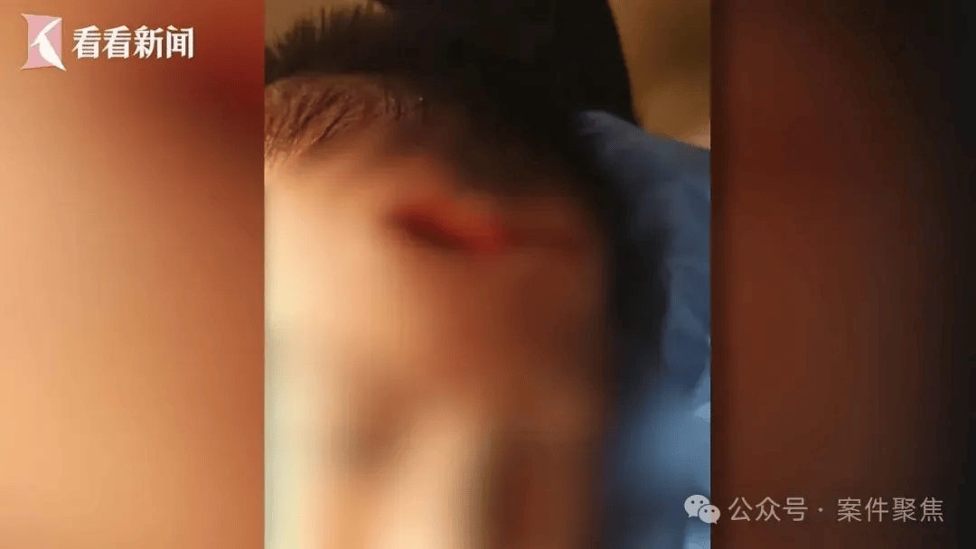 埃及超级联赛_血流不止埃及超级联赛,脸上缝30多针需整容!上海一知名火锅店发生意外,顾客和商家互相指责……